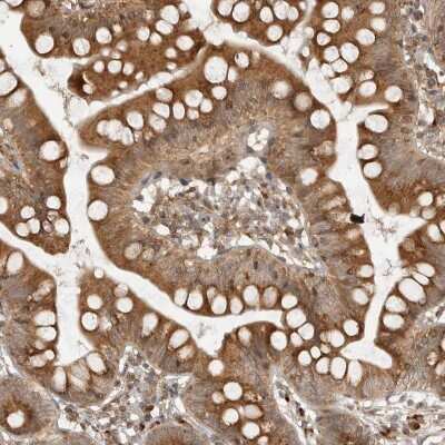 Immunohistochemistry-Paraffin: alpha COP I Antibody [NBP1-89705]