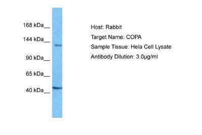Western Blot: alpha COP I Antibody [NBP1-59297]
