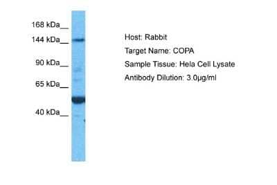 Western Blot: alpha COP I Antibody [NBP1-59297]