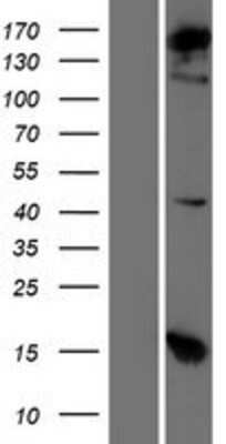 Western Blot: alpha COP I Overexpression Lysate [NBP2-10923]