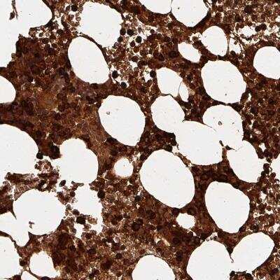 Immunohistochemistry: alpha-Defensin 1 Antibody [NBP2-46808]