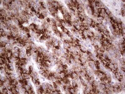 Immunohistochemistry: alpha Desmuslin Antibody (OTI7H6) [NBP2-46044]