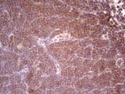 Immunohistochemistry: alpha Desmuslin Antibody (OTI7H6) [NBP2-46044]