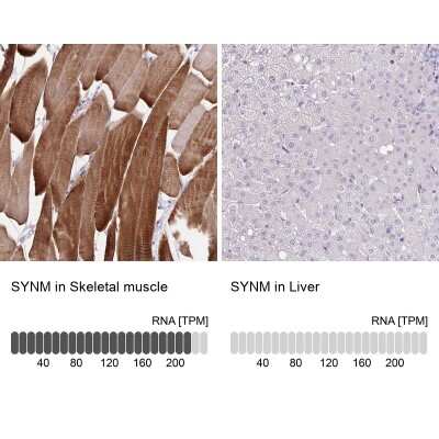 Immunohistochemistry-Paraffin: alpha Desmuslin Antibody [NBP2-37892]