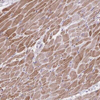 Immunohistochemistry-Paraffin: alpha Desmuslin Antibody [NBP2-37892]