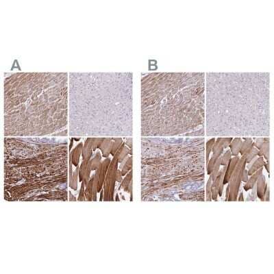 Immunohistochemistry-Paraffin: alpha Desmuslin Antibody [NBP2-37892]