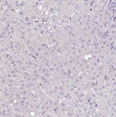 Immunohistochemistry-Paraffin: alpha Desmuslin Antibody [NBP2-37892]