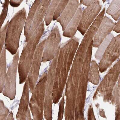Immunohistochemistry-Paraffin: alpha Desmuslin Antibody [NBP2-37892]