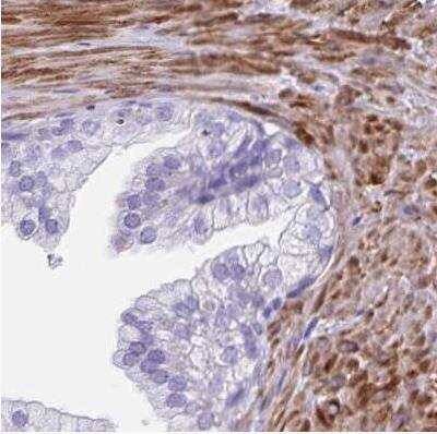 Immunohistochemistry-Paraffin: alpha Desmuslin Antibody [NBP2-37909]