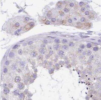 Immunohistochemistry-Paraffin: alpha Desmuslin Antibody [NBP2-37909]