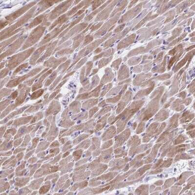 Immunohistochemistry-Paraffin: alpha Desmuslin Antibody [NBP2-37909]