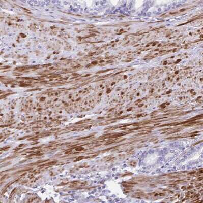 Immunohistochemistry-Paraffin: alpha Desmuslin Antibody [NBP2-37909]