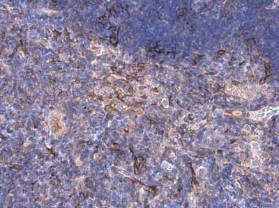 Immunohistochemistry-Paraffin: alpha Desmuslin Antibody [NBP3-13366]