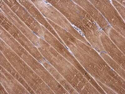 Immunohistochemistry-Paraffin: alpha Desmuslin Antibody [NBP3-13366]