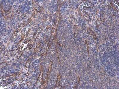 Immunohistochemistry-Paraffin: alpha Desmuslin Antibody [NBP3-13366]