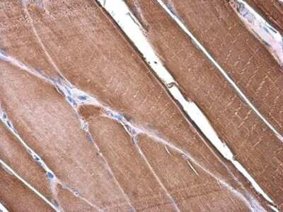 Immunohistochemistry-Paraffin: alpha Desmuslin Antibody [NBP3-13366]