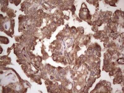 Immunohistochemistry: alpha Desmuslin Antibody (OTI7H6) - Azide and BSA Free [NBP2-71736]