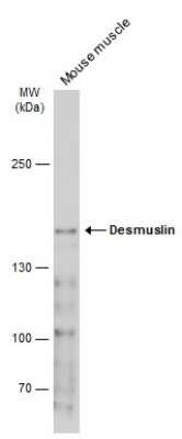 Western Blot: alpha Desmuslin Antibody [NBP3-13366]