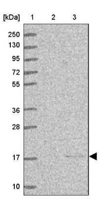 Western Blot: alpha Endosulfine Antibody [NBP2-13963]