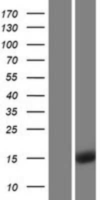 Western Blot: alpha Endosulfine Overexpression Lysate [NBP2-04512]