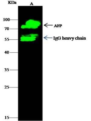 Immunoprecipitation: alpha-Fetoprotein/AFP Antibody (003) [NBP2-90069]
