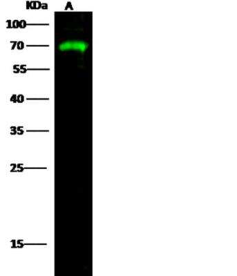 Western Blot: alpha-Fetoprotein/AFP Antibody (003) [NBP2-90069]