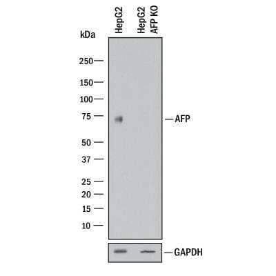 Knockout Validated: alpha-Fetoprotein/AFP Antibody (189508) [MAB13692]