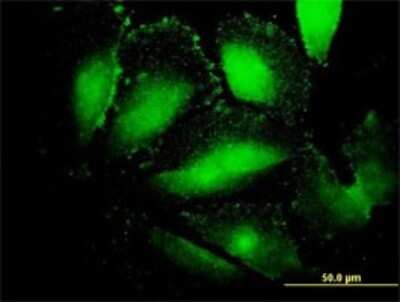 Immunocytochemistry/ Immunofluorescence: alpha-Fetoprotein/AFP Antibody (1G7) [H00000174-M01]