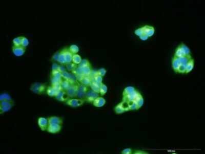 Immunocytochemistry/ Immunofluorescence: alpha-Fetoprotein/AFP Antibody (1G7) [H00000174-M01]