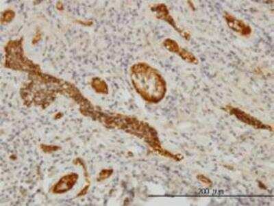 Immunohistochemistry-Paraffin: alpha-Fetoprotein/AFP Antibody (1G7) [H00000174-M01]