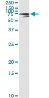 Immunoprecipitation: alpha-Fetoprotein/AFP Antibody (1G7) [H00000174-M01]