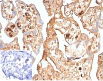 Immunohistochemistry-Paraffin: alpha-Fetoprotein/AFP Antibody (AFP/7007R) [NBP3-13870]