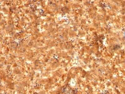Immunohistochemistry-Paraffin: alpha-Fetoprotein/AFP Antibody (C2 + C3 + MBS-12) - Azide and BSA Free [NBP2-48013]