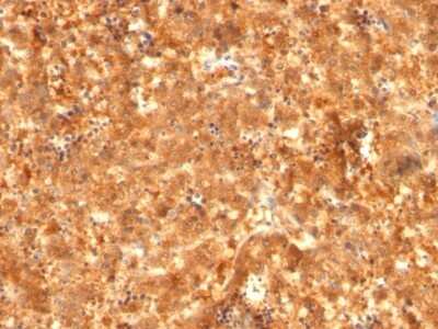 Immunohistochemistry-Paraffin: alpha-Fetoprotein/AFP Antibody (C2 + C3 + MBS-12) [NBP2-45011]