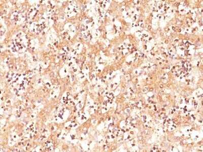 Immunohistochemistry-Paraffin: alpha-Fetoprotein/AFP Antibody (C3) - Azide and BSA Free [NBP2-34577]