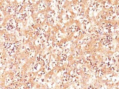 Immunohistochemistry-Paraffin: alpha-Fetoprotein/AFP Antibody (C3) [NBP2-32914]