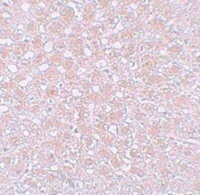 Immunohistochemistry-Paraffin: alpha-Fetoprotein/AFP Antibody - BSA Free [NBP1-76275]