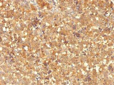 Immunohistochemistry-Paraffin: alpha-Fetoprotein/AFP Antibody (MBS-12) - IHC-Prediluted [NBP2-48120]