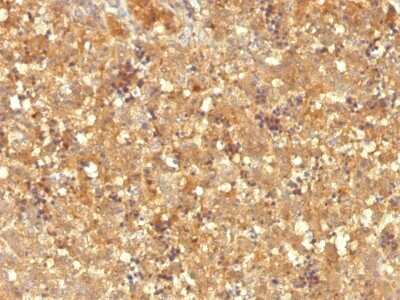 Immunohistochemistry-Paraffin: alpha-Fetoprotein/AFP Antibody (MBS-12) [NBP2-45013]