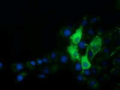 Immunocytochemistry/ Immunofluorescence: alpha-Fetoprotein/AFP Antibody (OTI2A9) - Azide and BSA Free [NBP2-70103]