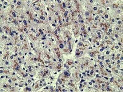 Immunohistochemistry: alpha-Fetoprotein/AFP Antibody (OTI2A9) - Azide and BSA Free [NBP2-70103]