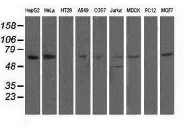 Western Blot: alpha-Fetoprotein/AFP Antibody (OTI2A9)Azide and BSA Free [NBP2-70103]