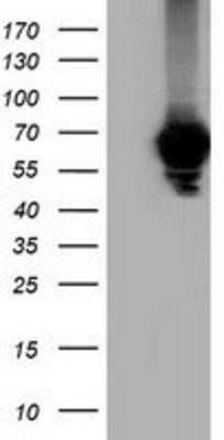 Western Blot: alpha-Fetoprotein/AFP Antibody (OTI2A9)Azide and BSA Free [NBP2-70103]