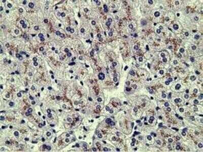 Immunohistochemistry-Paraffin: alpha-Fetoprotein/AFP Antibody (OTI2A9) [NBP2-03084]