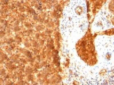 Immunohistochemistry-Paraffin: alpha-Fetoprotein/AFP Antibody (SPM334) - Azide and BSA Free [NBP2-37754]