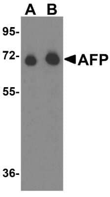 Western Blot: alpha-Fetoprotein/AFP AntibodyBSA Free [NBP1-76275]