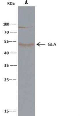 Immunoprecipitation: alpha-Galactosidase A/GLA Antibody (001) [NBP2-90047]