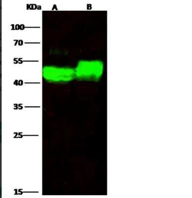 Western Blot: alpha-Galactosidase A/GLA Antibody (201) [NBP2-90048]