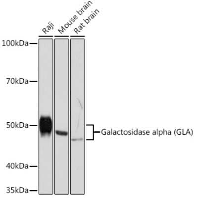 Western Blot: alpha-Galactosidase A/GLA Antibody (7G8T9) [NBP3-16563]