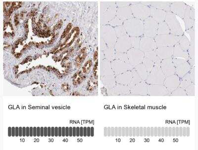 Immunohistochemistry-Paraffin: alpha-Galactosidase A/GLA Antibody [NBP1-89796]